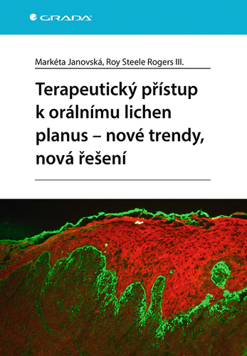 Terapeutický přístup k orálnímu lichen planus - nové trendy, nová řešení