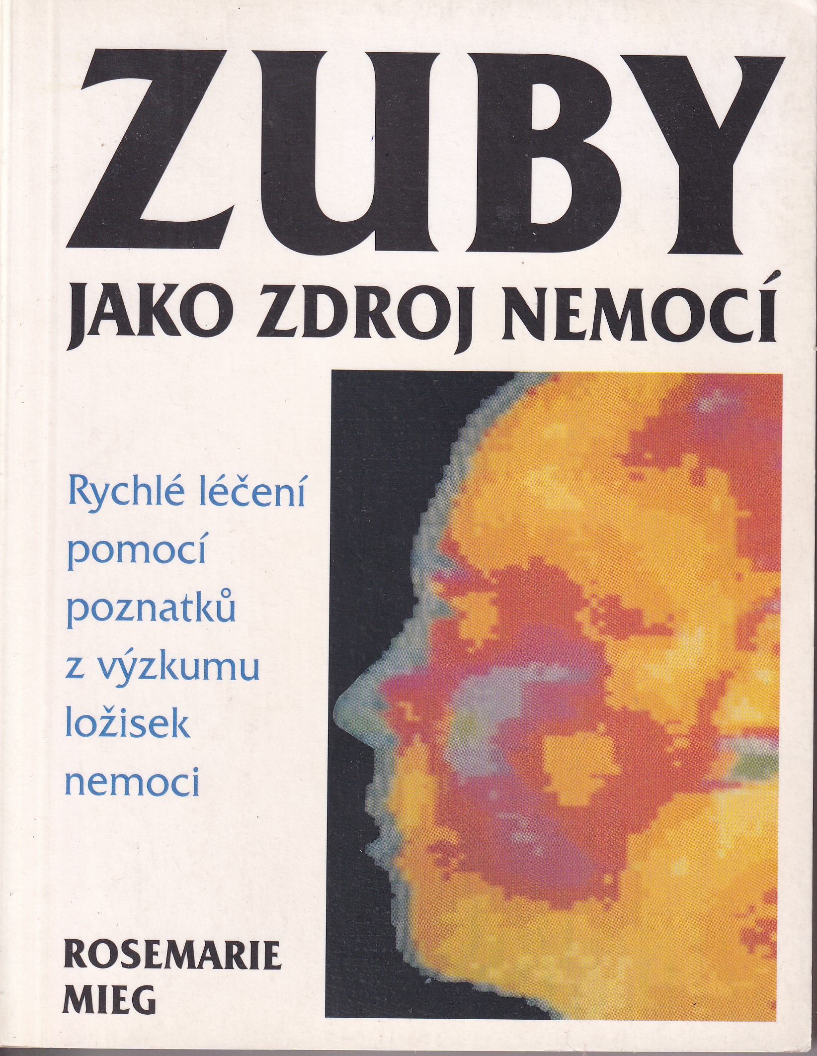 Zuby jako zdroj nemocí  rychlé léčení pomocí poznatků z výzkumu ložisek nemoci