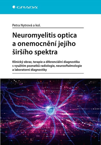 Neuromyelitis optica a poruchy jejího šišího spektra